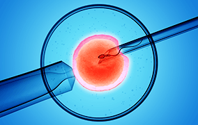 胚胎植入前遗传学筛查