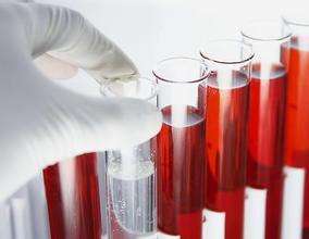 东莞企石遗传病基因检测的意义何在？